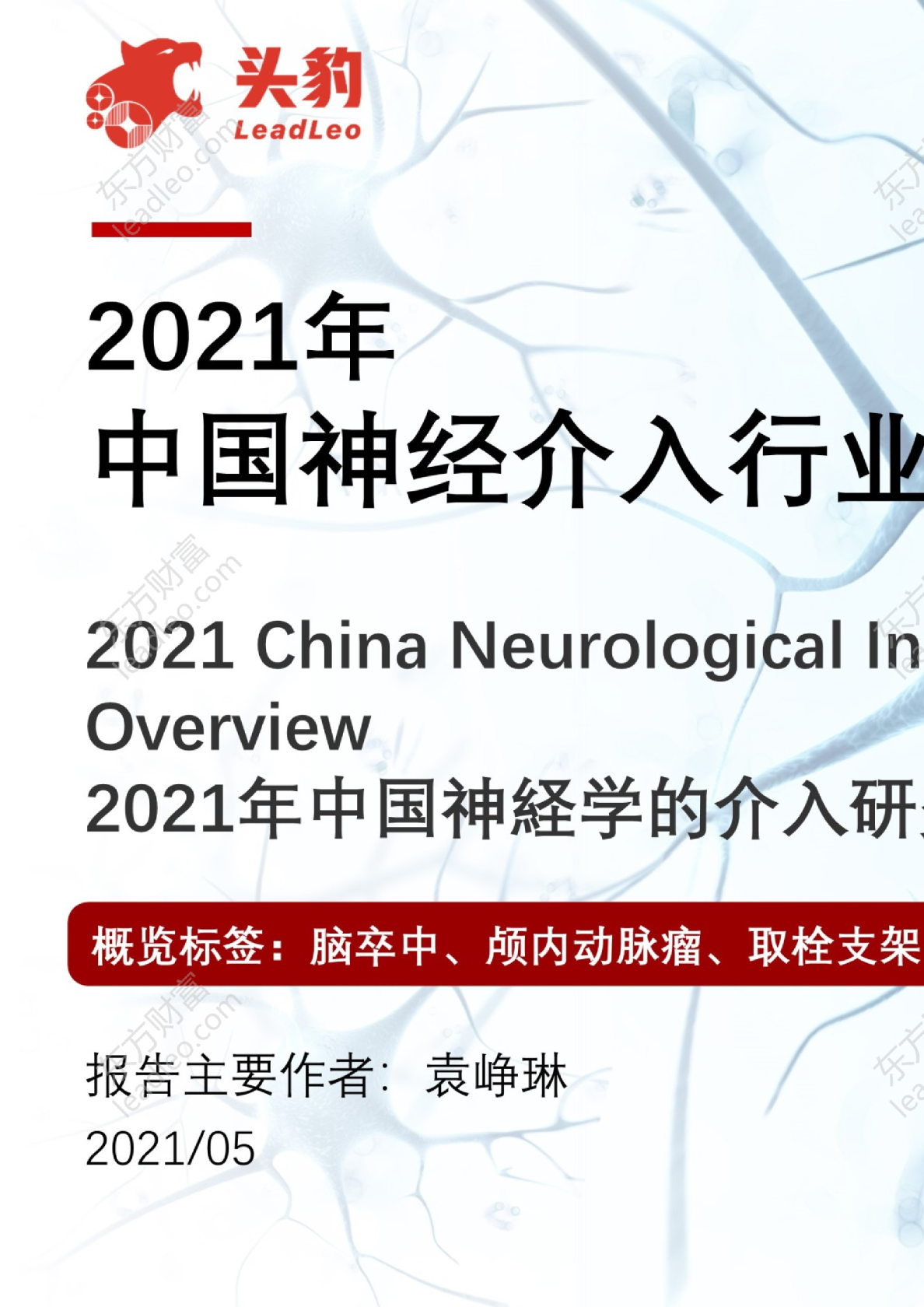 2021年中国神经介入行业趋势展望